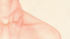 Hals mit Abdrücken